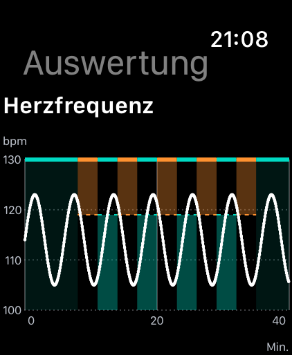 Pulsanalyse mit weißer Kurve und orangefarbenen und mintfarbenen Intervallbereichen; fiktive Messwerte.
