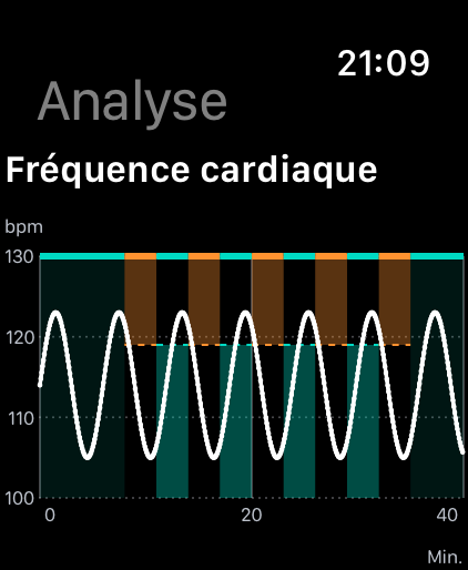 Analyse de la fréquence cardiaque avec une courbe blanche et des plages d’intervalles orange et menthe ; mesures fictives.