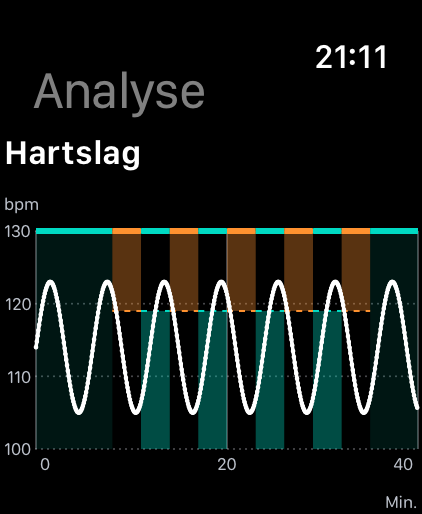 Hartslaganalyse met een witte curve en oranje en mintgroene intervalbereiken; fictieve metingen.